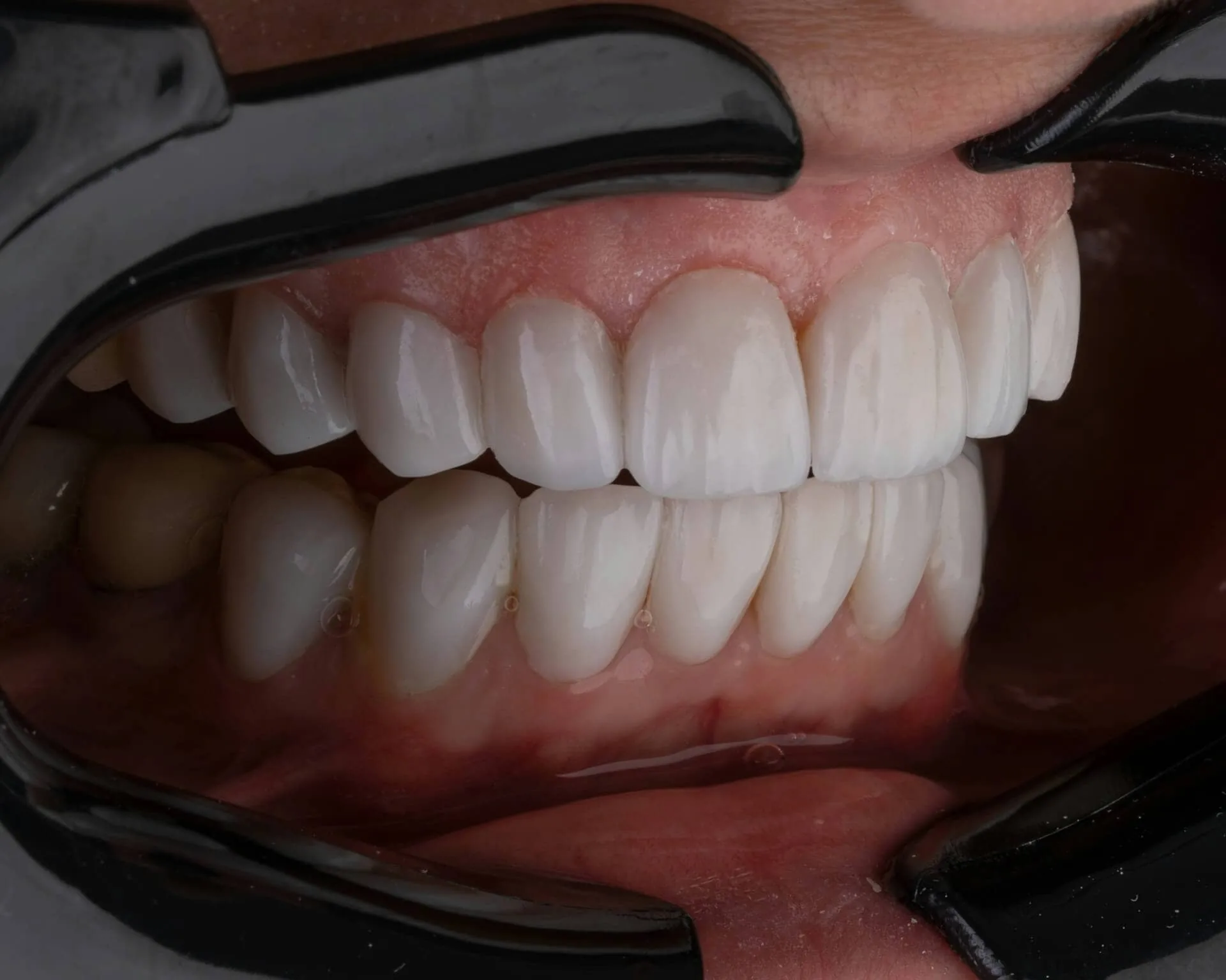 A persons mouth with teeth