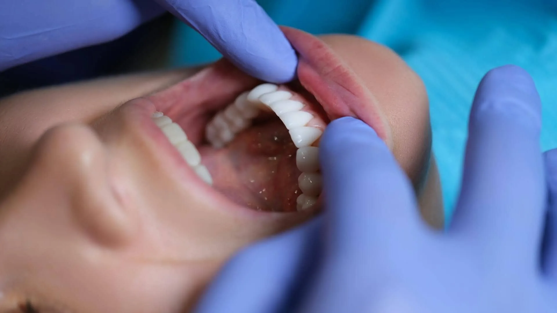 A person checking a person's mouth