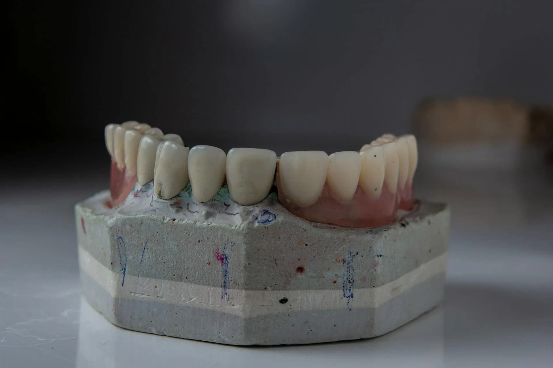 A closeup of a tooth model