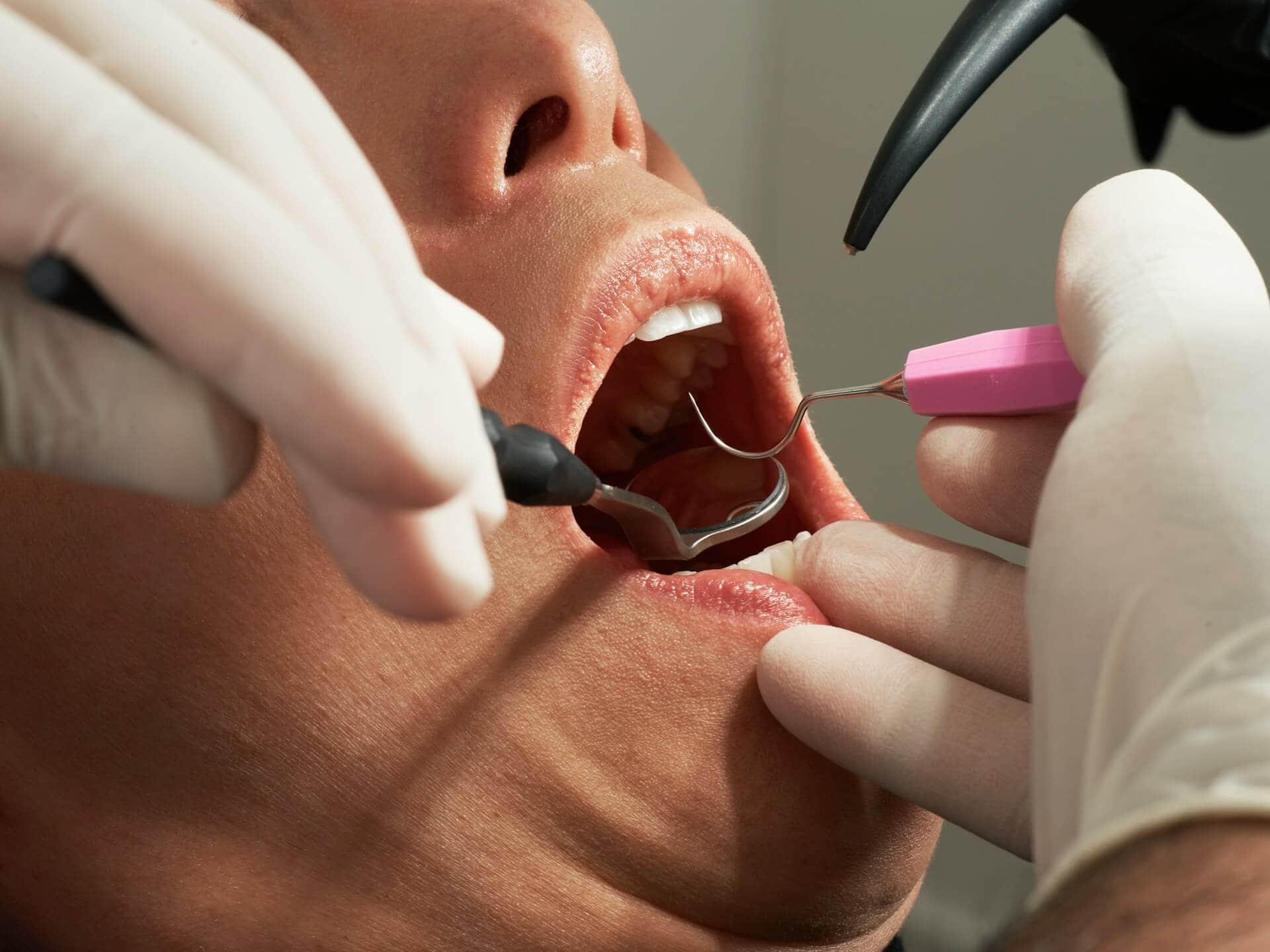A person's open mouth