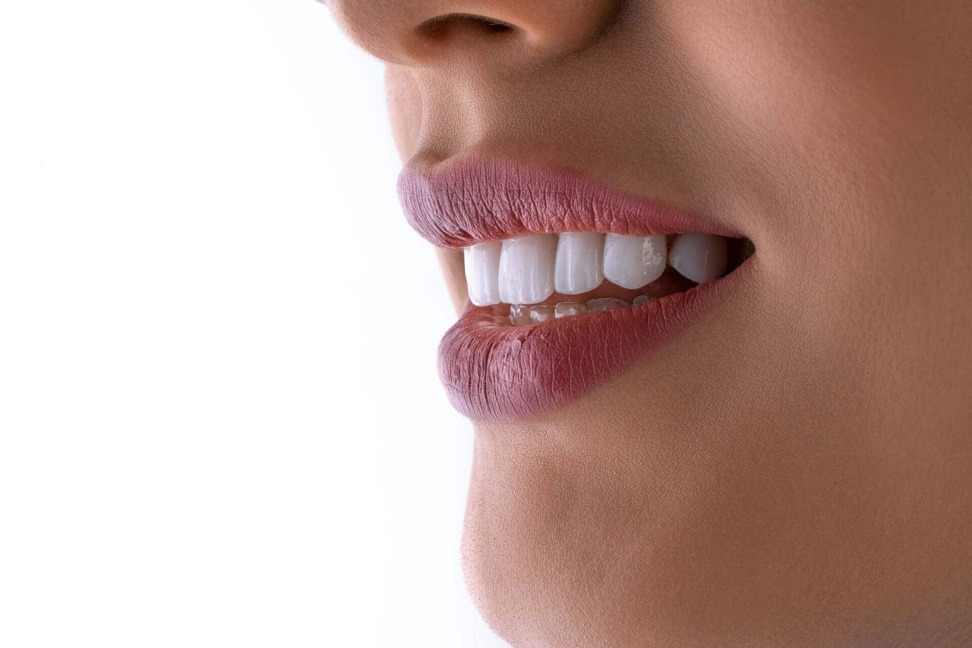 Close-up of a bright, healthy smile, illustrating the difference between Professional teeth whitening vs whitening strips