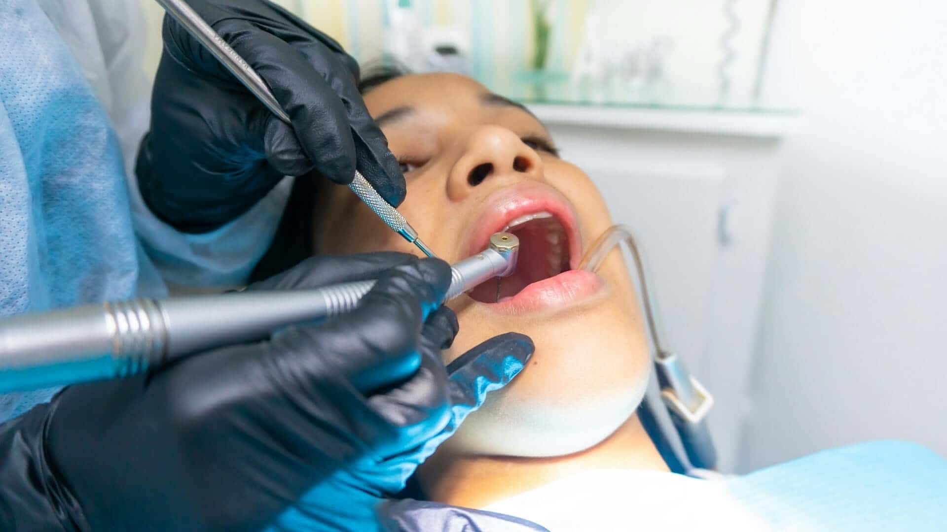 Teeth After Veneers: What Changes — And What Happens Next?