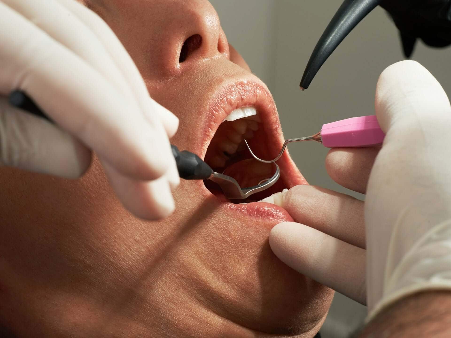 Patient undergoing a dental exam to evaluate suitability for porcelain veneers