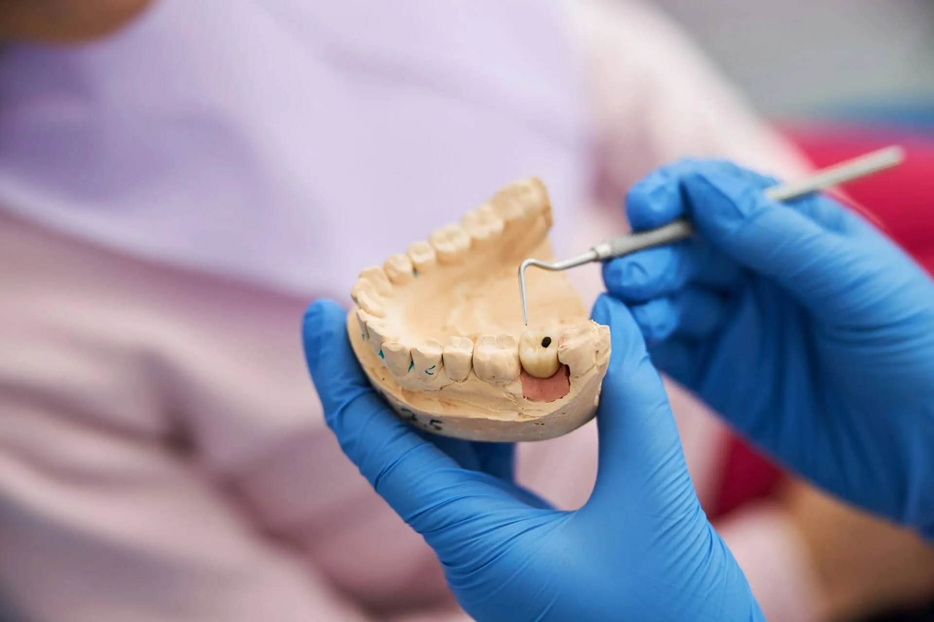 Dental professional wearing blue gloves examining a detailed tooth model with a dental probe.